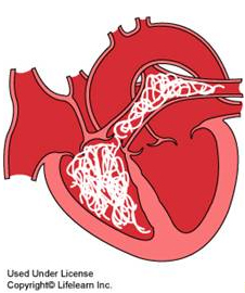 heartworm diagram