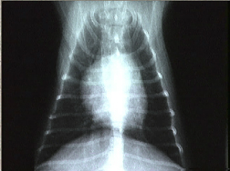 x ray